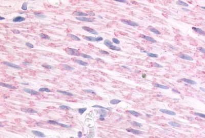 alpha-2c Adrenergic Receptor Antibody in Immunohistochemistry (Paraffin) (IHC (P))