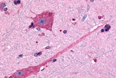 DRD2 Antibody in Immunohistochemistry (Paraffin) (IHC (P))
