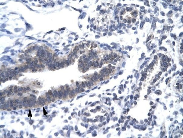 CDK7 Antibody in Immunohistochemistry (Paraffin) (IHC (P))