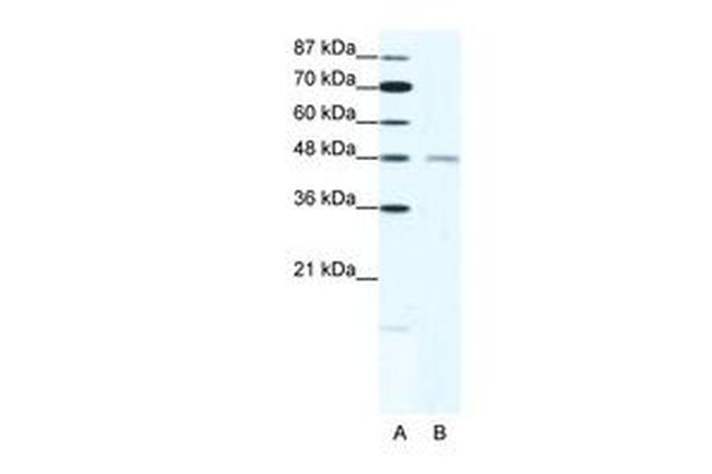 CHRND Antibody in Western Blot (WB)