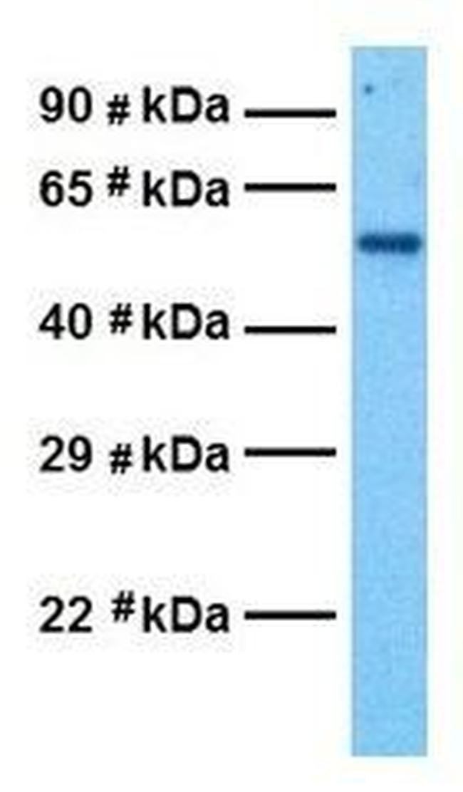 GABRD Antibody in Western Blot (WB)