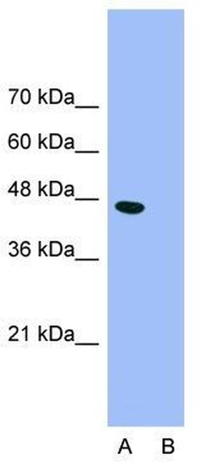 GABRP Antibody in Western Blot (WB)