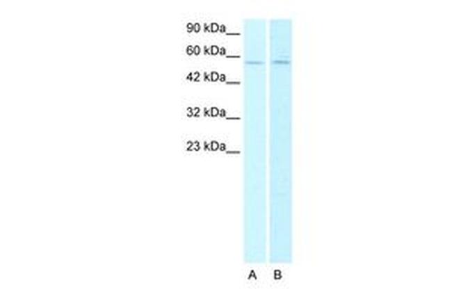 CHRNA2 Antibody in Western Blot (WB)