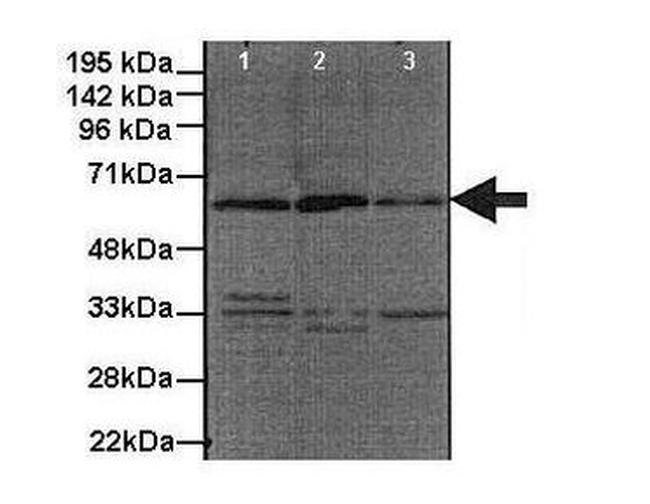 GDI1 Antibody in Western Blot (WB)