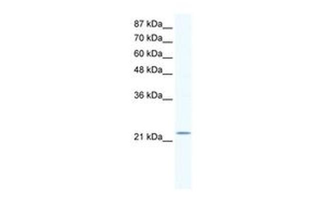 RGS10 Antibody in Western Blot (WB)