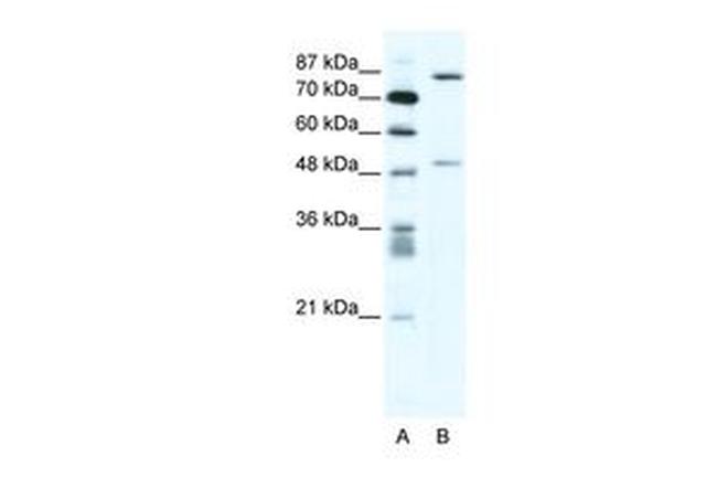 MMP10 Antibody in Western Blot (WB)