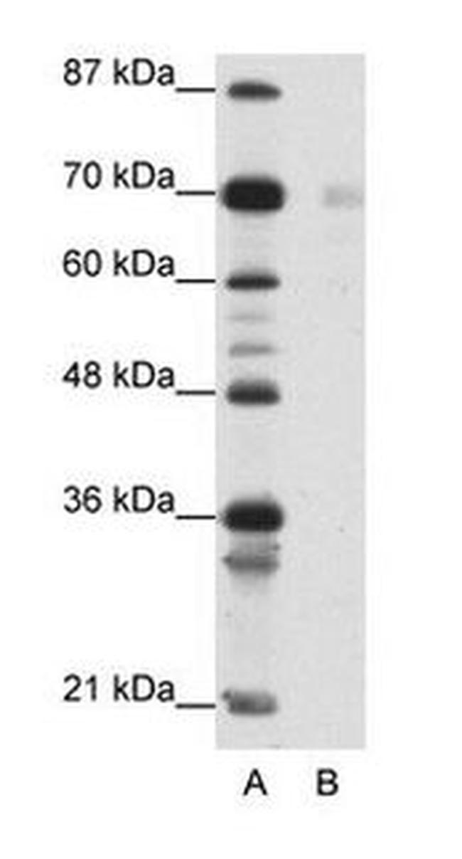 HSP90 beta Antibody in Western Blot (WB)