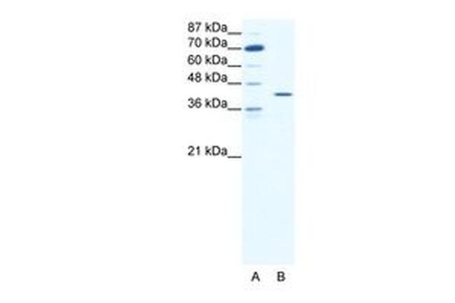 c-Fos Antibody in Western Blot (WB)
