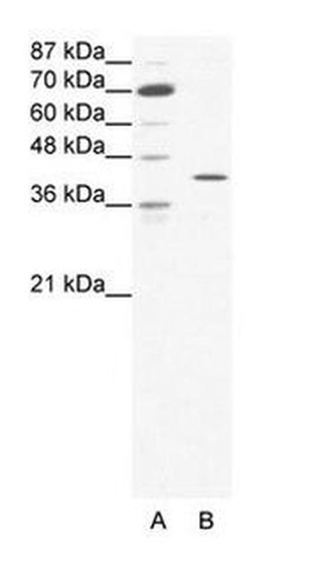C/EBP zeta Antibody in Western Blot (WB)