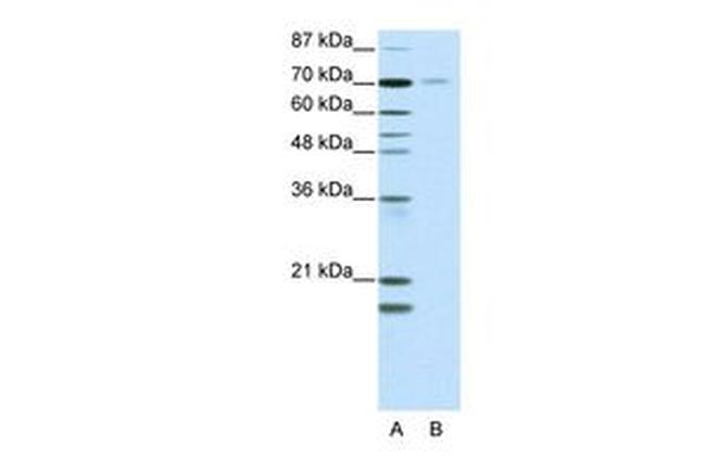 TR2 Antibody in Western Blot (WB)