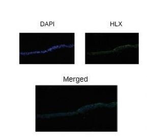 HLX Antibody in Immunohistochemistry (Paraffin) (IHC (P))