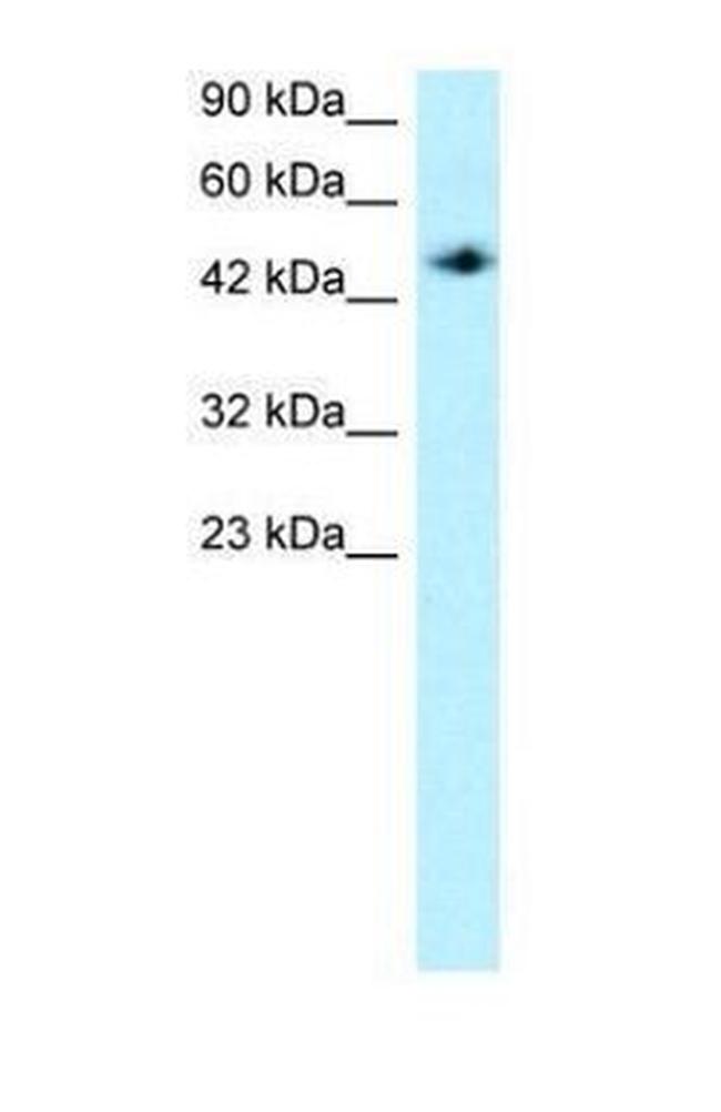 MAPKAPK2 Antibody in Western Blot (WB)