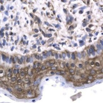 GTF2F2 Antibody in Immunohistochemistry (IHC)