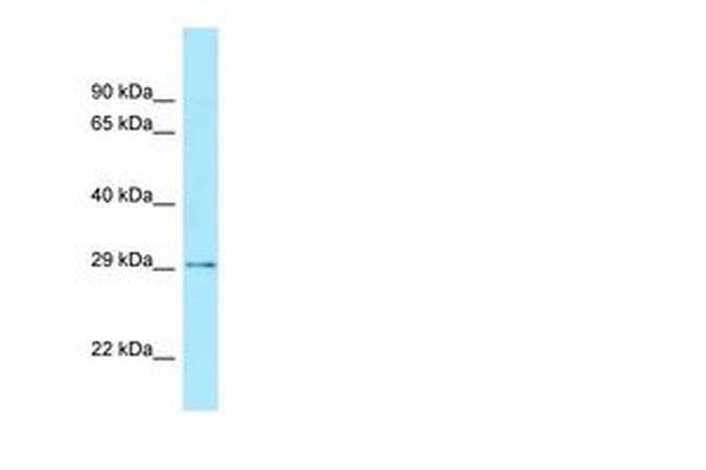 CDX2 Antibody in Western Blot (WB)