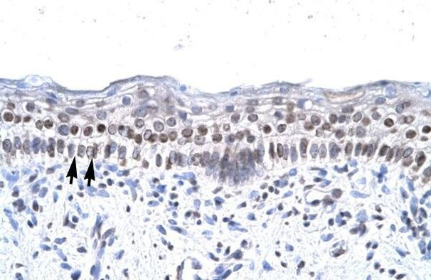 ZNF500 Antibody in Immunohistochemistry (Paraffin) (IHC (P))