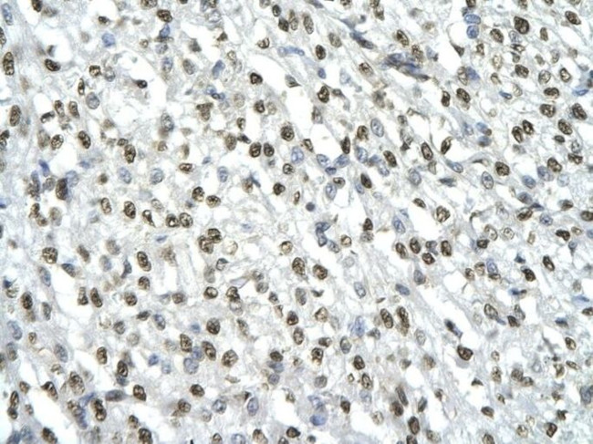 HMGB2 Antibody in Immunohistochemistry (Paraffin) (IHC (P))