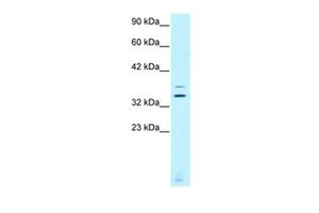 CHX10 Antibody in Western Blot (WB)
