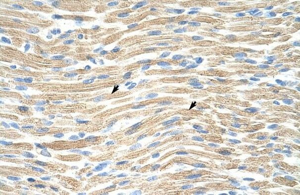 LMX1A Antibody in Immunohistochemistry (Paraffin) (IHC (P))