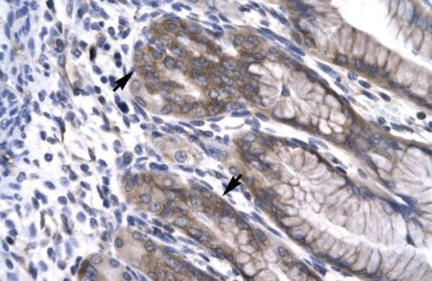 NPAS1 Antibody in Immunohistochemistry (Paraffin) (IHC (P))