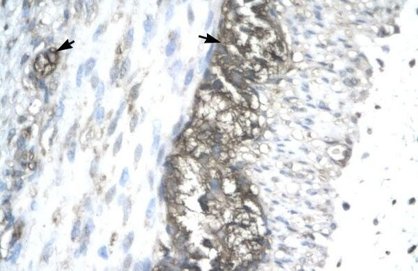 ACAT2 Antibody in Immunohistochemistry (Paraffin) (IHC (P))