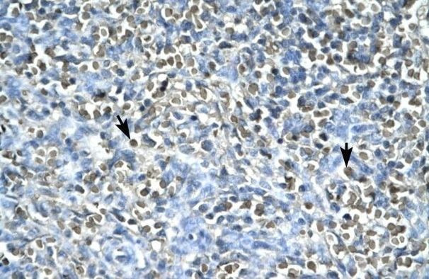 ASGR2 Antibody in Immunohistochemistry (Paraffin) (IHC (P))