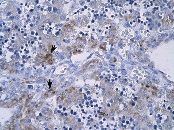 RGS9 Antibody in Immunohistochemistry (Paraffin) (IHC (P))