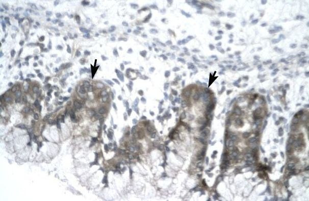 IVNS1ABP Antibody in Immunohistochemistry (Paraffin) (IHC (P))