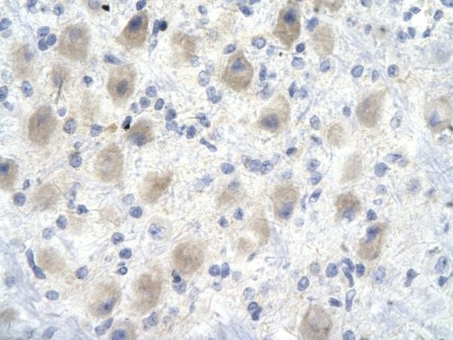 GAS41 Antibody in Immunohistochemistry (Paraffin) (IHC (P))