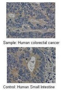 MMP19 Antibody in Immunohistochemistry (Paraffin) (IHC (P))