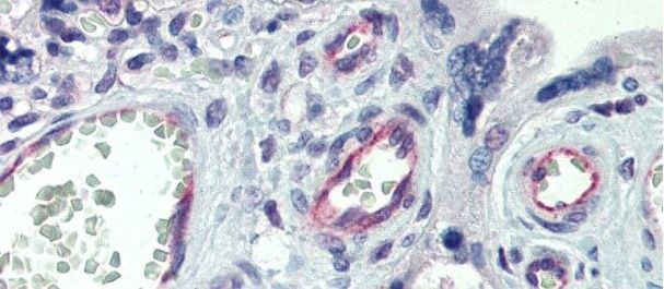 Claudin 23 Antibody in Immunohistochemistry (Paraffin) (IHC (P))