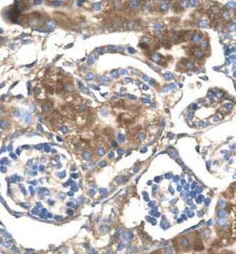 SLC17A3 Antibody in Immunohistochemistry (IHC)