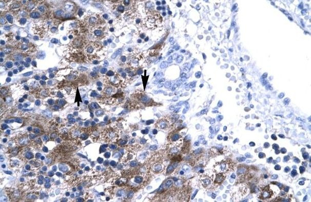NFYA Antibody in Immunohistochemistry (Paraffin) (IHC (P))