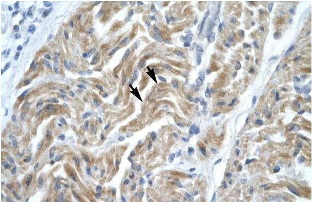 NFYA Antibody in Immunohistochemistry (Paraffin) (IHC (P))