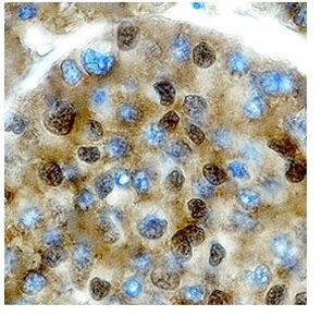 PIT1 Antibody in Immunohistochemistry (Paraffin) (IHC (P))