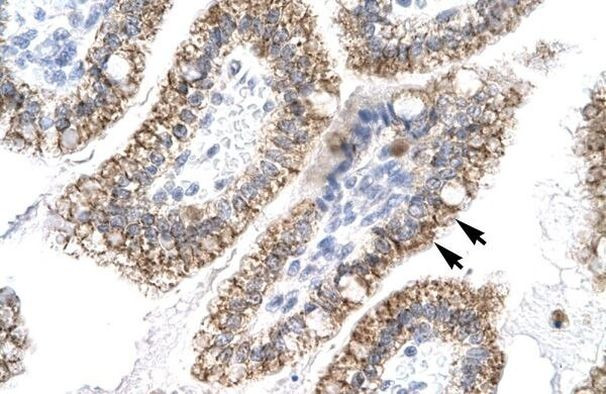 AEBP1 Antibody in Immunohistochemistry (Paraffin) (IHC (P))