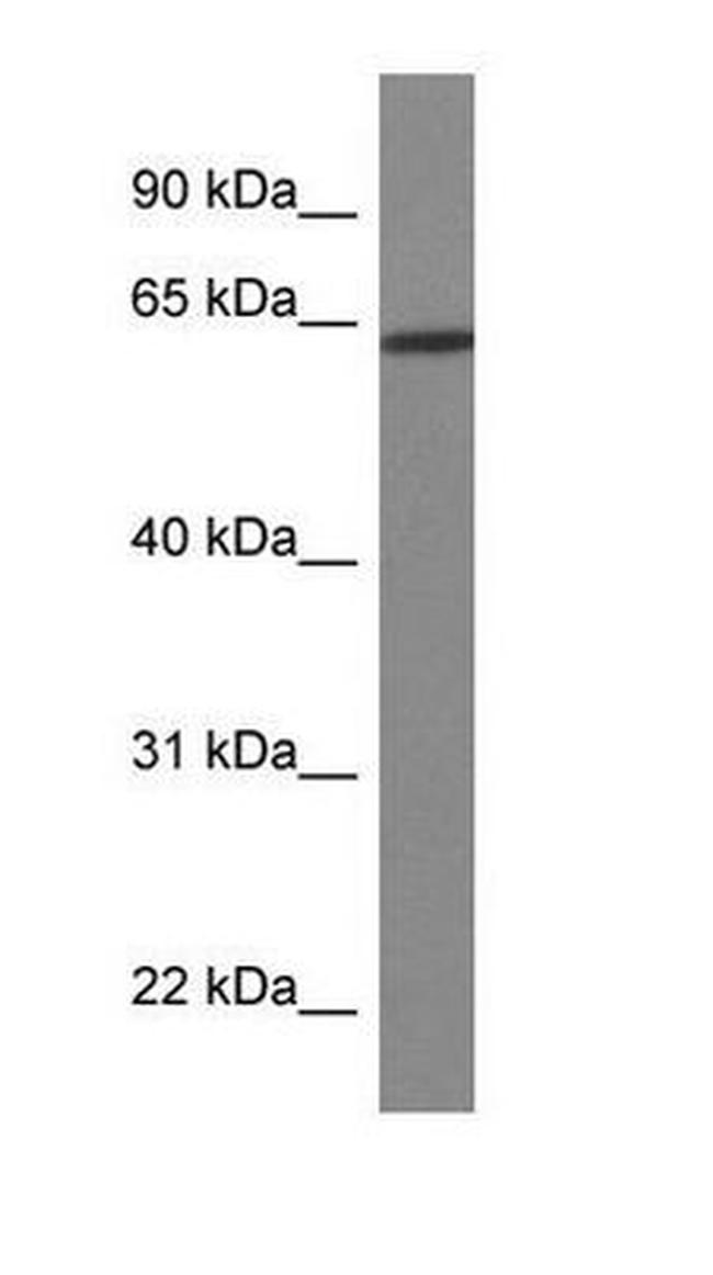 HOXD3 Antibody in Western Blot (WB)