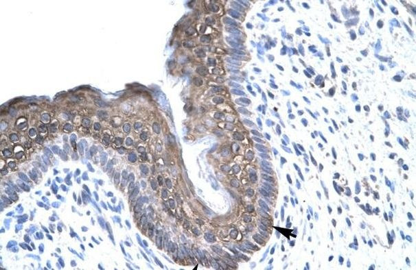 FOXE3 Antibody in Immunohistochemistry (Paraffin) (IHC (P))