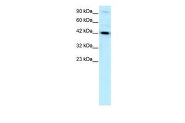 TCF2 Antibody in Western Blot (WB)
