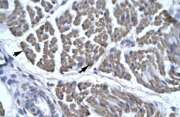 EYA3 Antibody in Immunohistochemistry (Paraffin) (IHC (P))