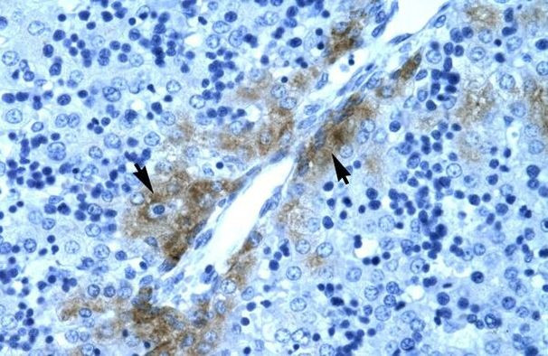 GATA3 Antibody in Immunohistochemistry (Paraffin) (IHC (P))