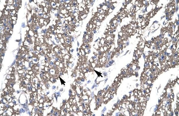 SMAD6 Antibody in Immunohistochemistry (Paraffin) (IHC (P))