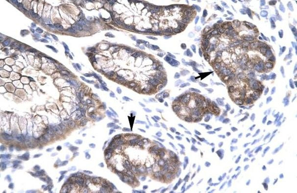 MOX1 Antibody in Immunohistochemistry (Paraffin) (IHC (P))
