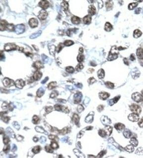 CITED1 Antibody in Immunohistochemistry (IHC)