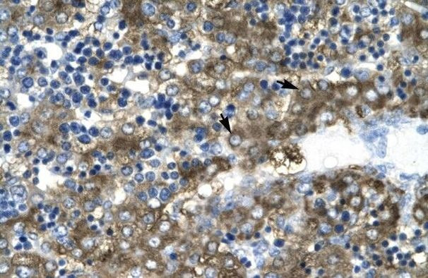 GATA2 Antibody in Immunohistochemistry (Paraffin) (IHC (P))
