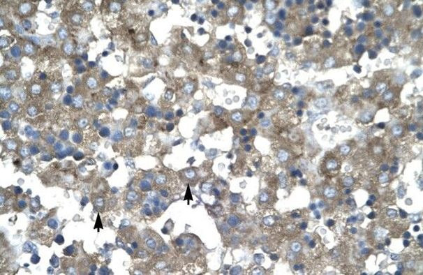 KLF15 Antibody in Immunohistochemistry (Paraffin) (IHC (P))