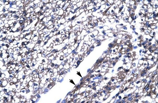 ThPOK Antibody in Immunohistochemistry (Paraffin) (IHC (P))