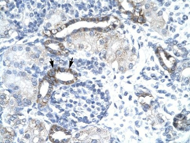 EVX1 Antibody in Immunohistochemistry (Paraffin) (IHC (P))