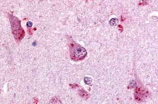 GPR68 Antibody in Immunohistochemistry (Paraffin) (IHC (P))