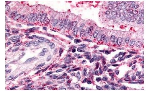 TBXA2R Antibody in Immunohistochemistry (Paraffin) (IHC (P))