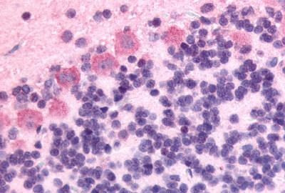 GPR89A Antibody in Immunohistochemistry (Paraffin) (IHC (P))